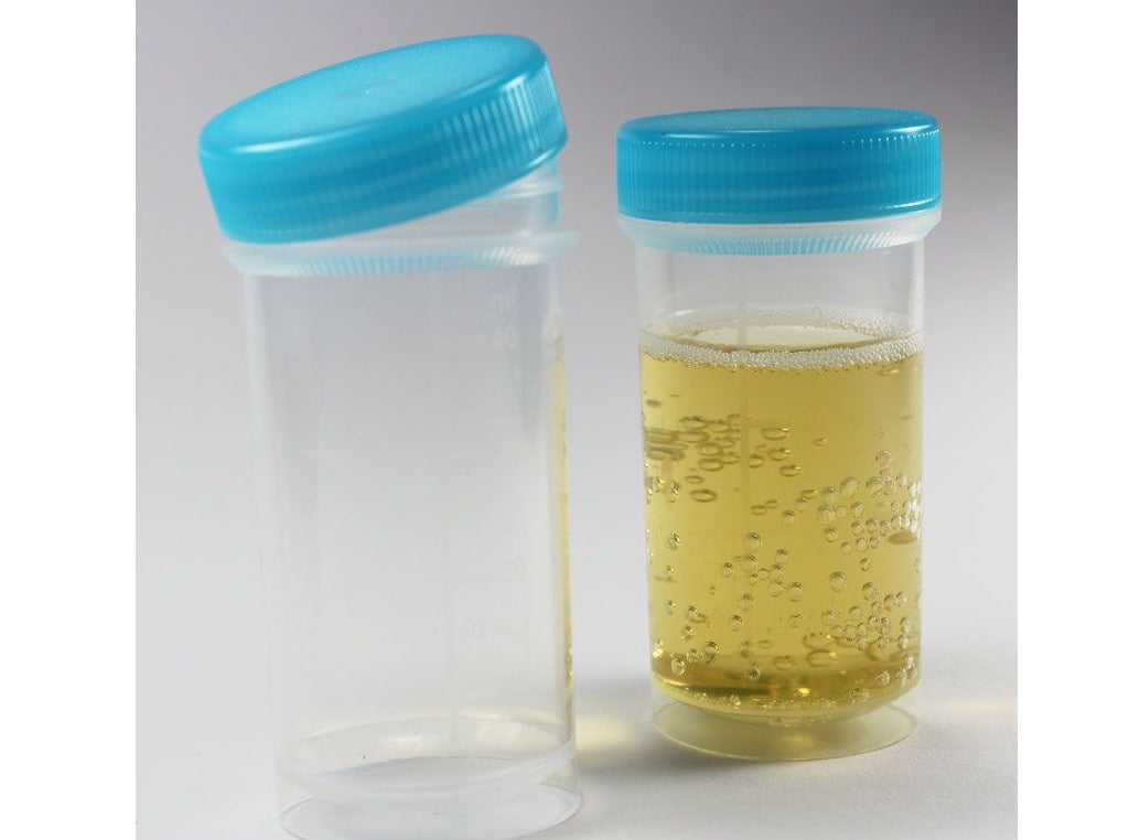 Pathologie-potje met blauw deksel