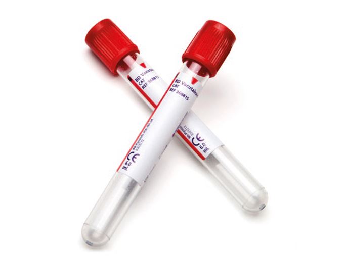 Vacut. serumbuis hg/pl, 10 ml rood